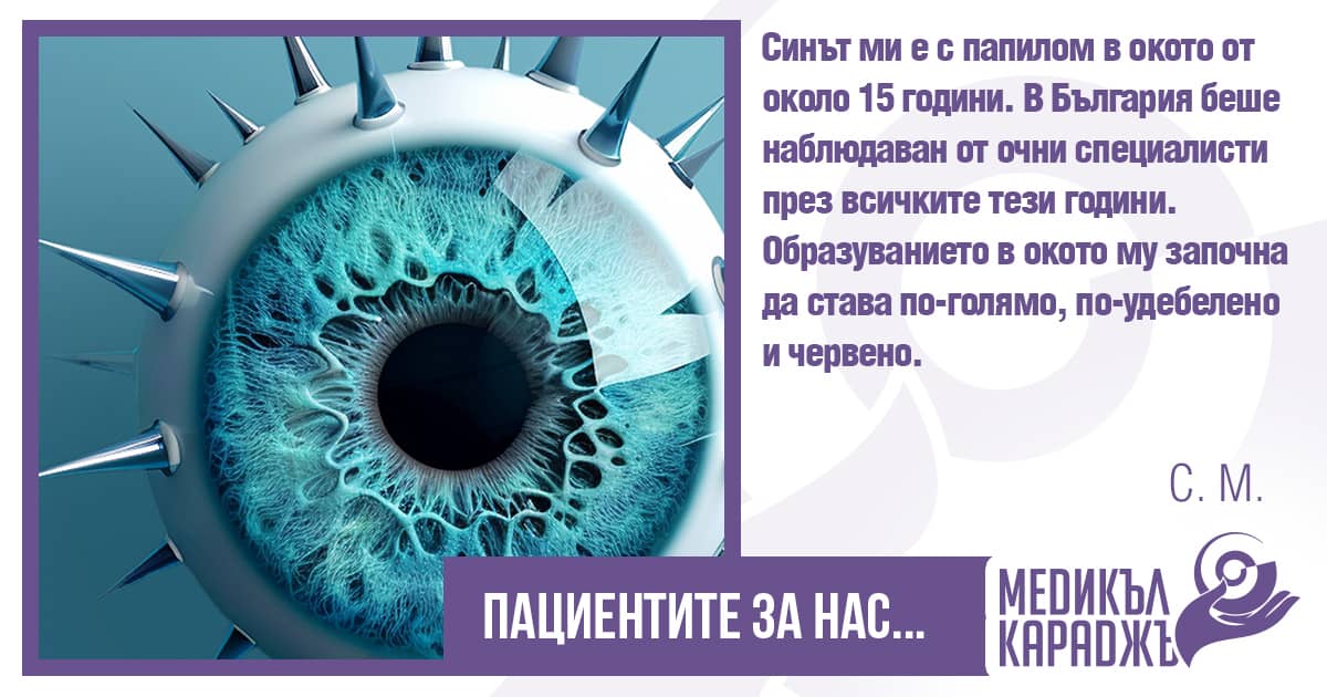 папилом в окото 