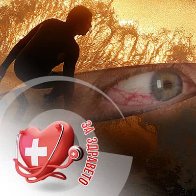 птеригиума