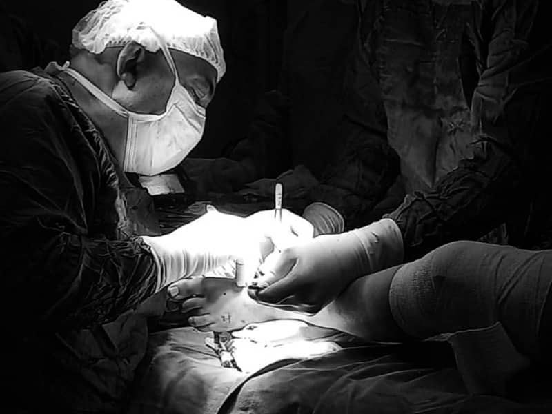 тибиална хемимелия