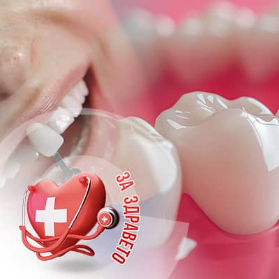 Фасети и циркониеви корони FM