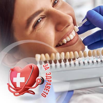 фасети без изпиляване на зъбите превю