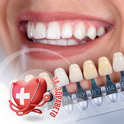 Фасетите превю