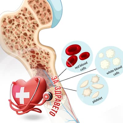 Костномозъчна трансплантация превю