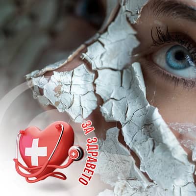 Лицева парализа FM